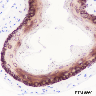 Anti-Keratin 14 Rabbit mAb