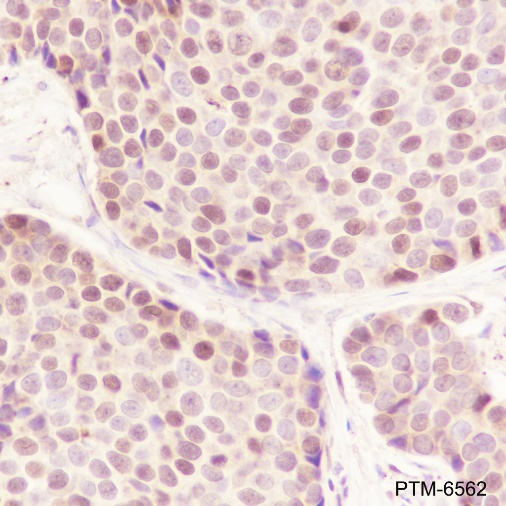 Anti-CBX4 Rabbit mAb