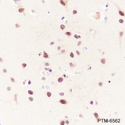 Anti-CBX4 Rabbit mAb