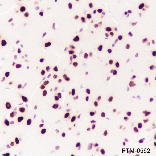 Anti-CBX4 Rabbit mAb