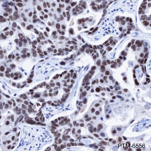 Anti-GTF3C4 Mouse mAb