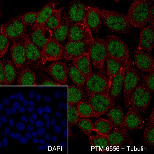 Anti-GTF3C4 Mouse mAb