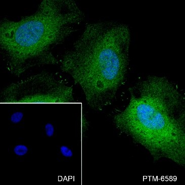 Anti-Thymidylate Synthase Rabbit mAb