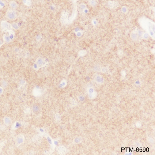 Anti-GABA A Receptor alpha 1 Rabbit mAb