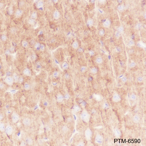 Anti-GABA A Receptor alpha 1 Rabbit mAb