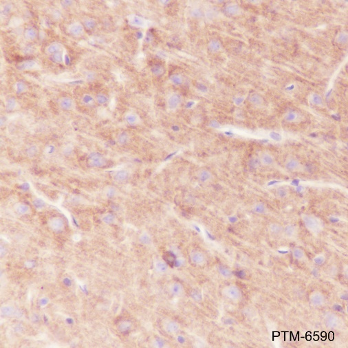 Anti-GABA A Receptor alpha 1 Rabbit mAb