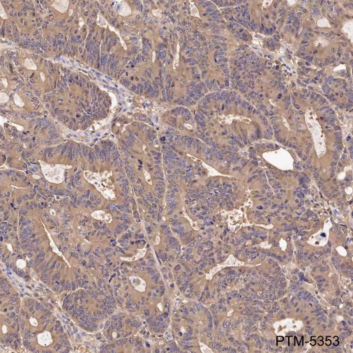 Anti-BID Mouse mAb