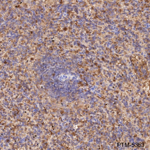 Anti-BID Mouse mAb