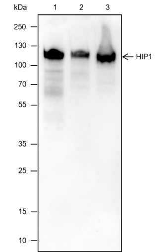 Anti-HIP1 Mouse mAb