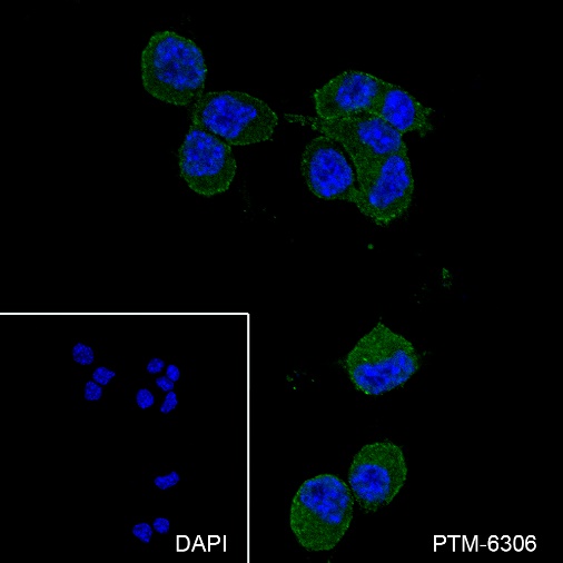 Anti-HIP1 Mouse mAb