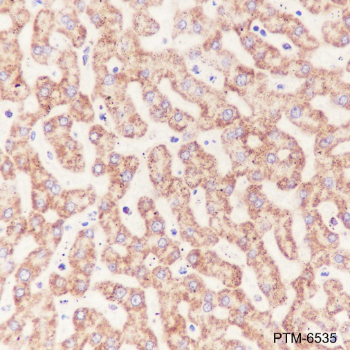 Anti-ATP5D Mouse mAb
