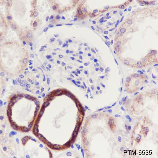 Anti-ATP5D Mouse mAb