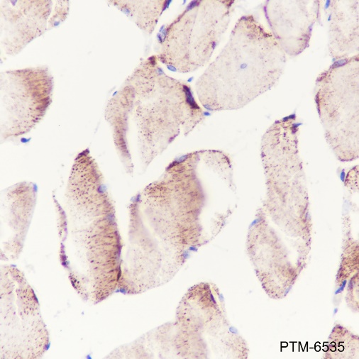 Anti-ATP5D Mouse mAb