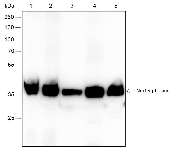 Anti-NPM1 Rabbit mAb