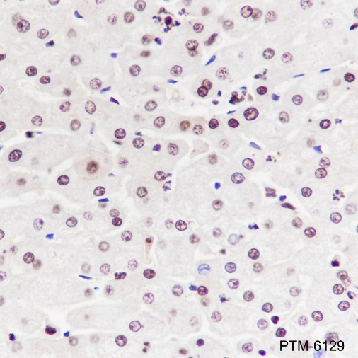 Anti-NPM1 Rabbit mAb