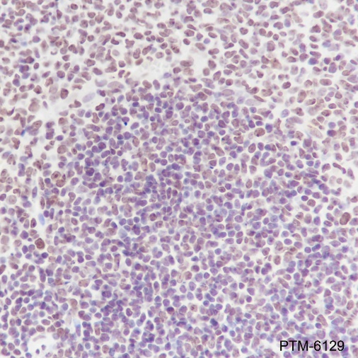 Anti-NPM1 Rabbit mAb