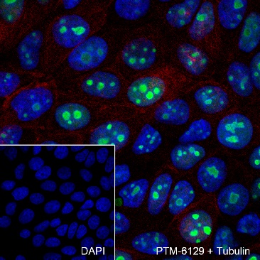 Anti-NPM1 Rabbit mAb