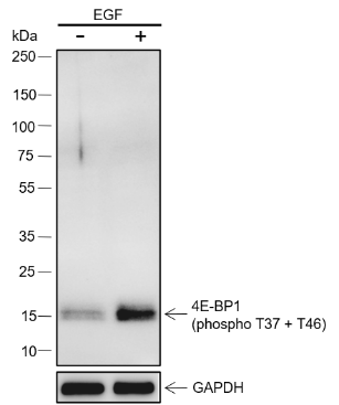 Anti-Phospho-4E-BP1 (Thr37/46) Rabbit mAb