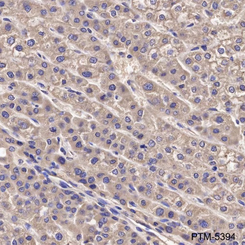 Anti-RPL3 Mouse mAb