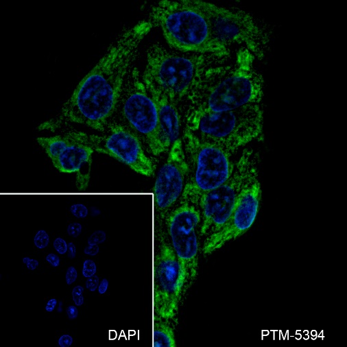 Anti-RPL3 Mouse mAb