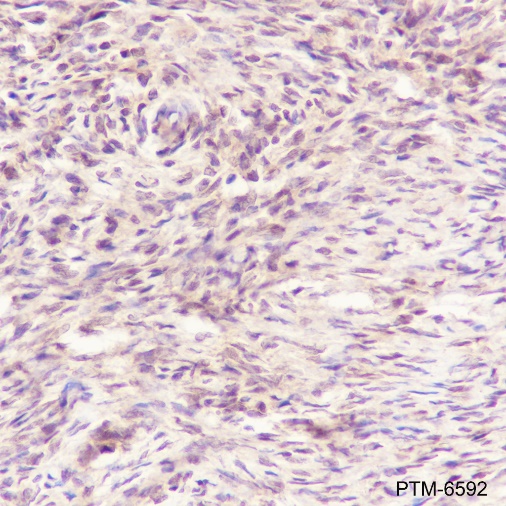 Anti-MBNL2 Mouse mAb
