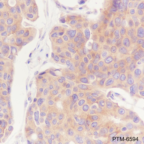 Anti-mTOR Mouse mAb