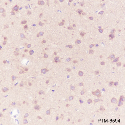 Anti-mTOR Mouse mAb