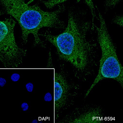 Anti-mTOR Mouse mAb