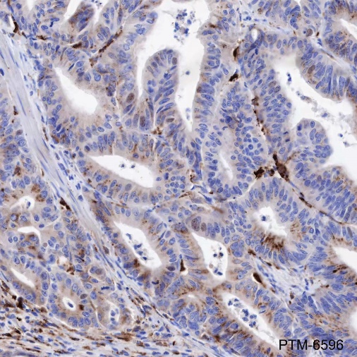 Anti-Legumain Mouse mAb