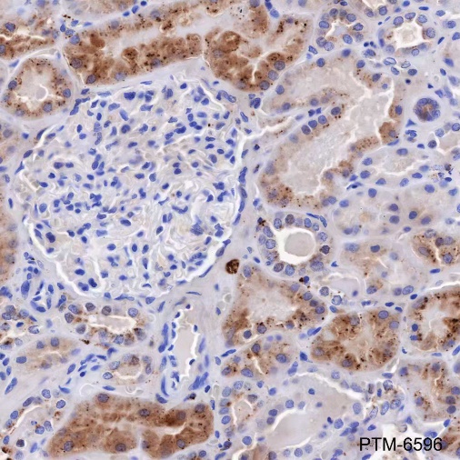 Anti-Legumain Mouse mAb