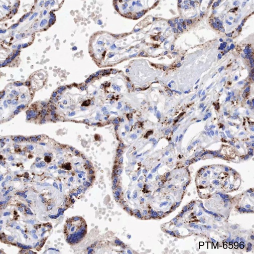 Anti-Legumain Mouse mAb