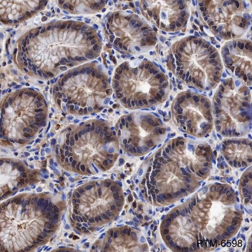 Anti-GST3/GSTP1 Mouse mAb