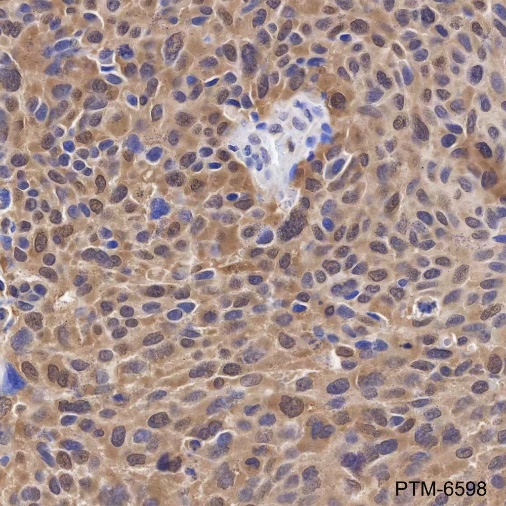 Anti-GST3/GSTP1 Mouse mAb