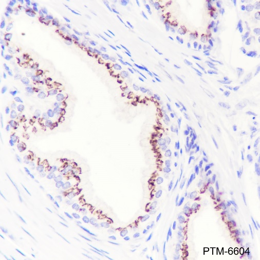 Anti-SLC45A3 Rabbit mAb