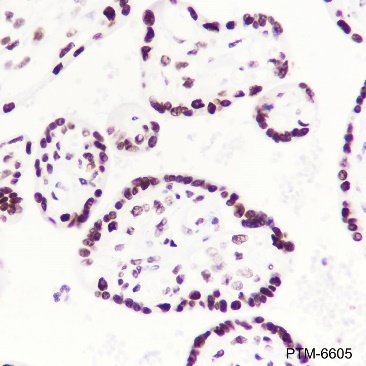 Anti-RING1B Rabbit mAb