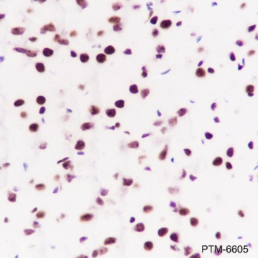 Anti-RING1B Rabbit mAb