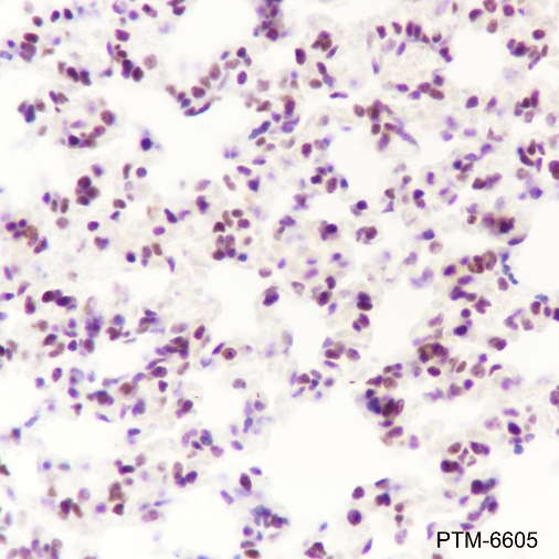 Anti-RING1B Rabbit mAb