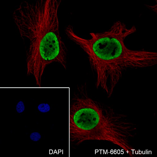 Anti-RING1B Rabbit mAb