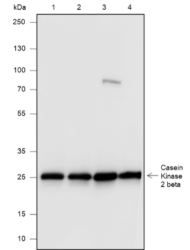 Anti-Casein Kinase 2 beta Rabbit mAb