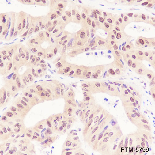 Anti-Casein Kinase 2 beta Rabbit mAb