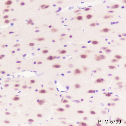 Anti-Casein Kinase 2 beta Rabbit mAb