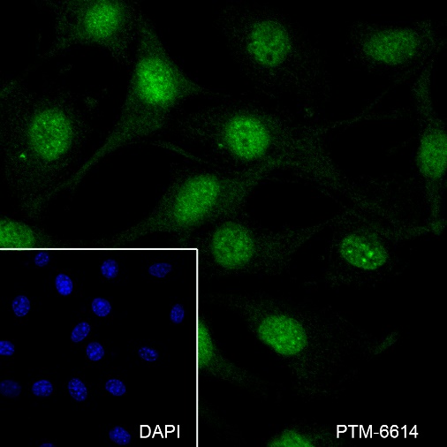 Anti-Casein Kinase 2 beta Rabbit mAb