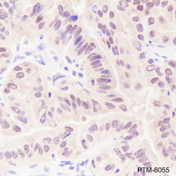 Anti-SUMO-1 Rabbit mAb (C-terminal)