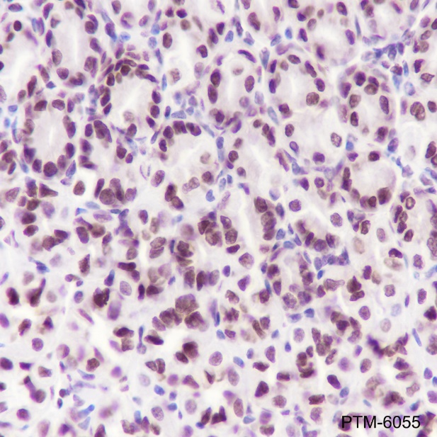 Anti-SUMO-1 Rabbit mAb (C-terminal)