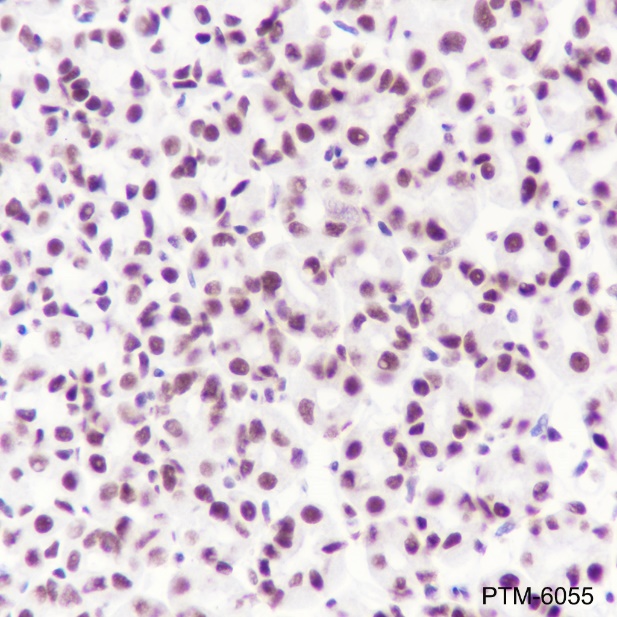 Anti-SUMO-1 Rabbit mAb (C-terminal)