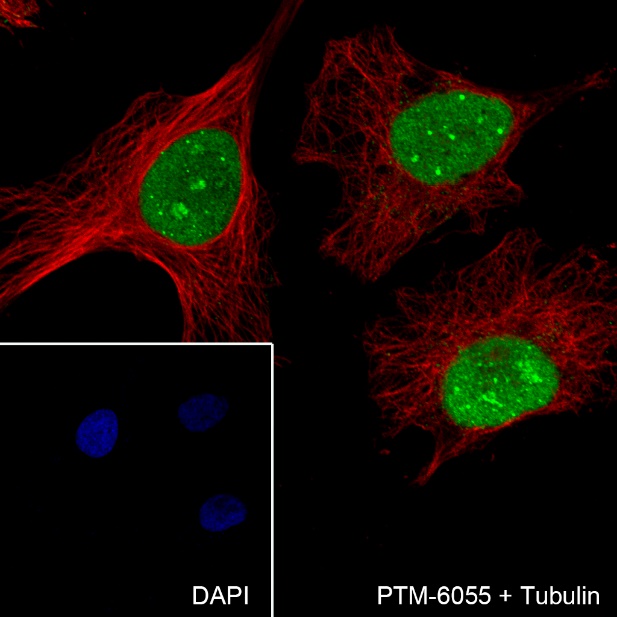 Anti-SUMO-1 Rabbit mAb (C-terminal)