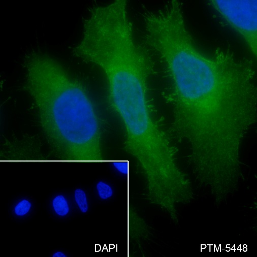 Anti-Met Rabbit mAb