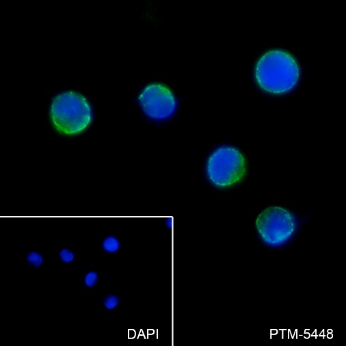 Anti-Met Rabbit mAb