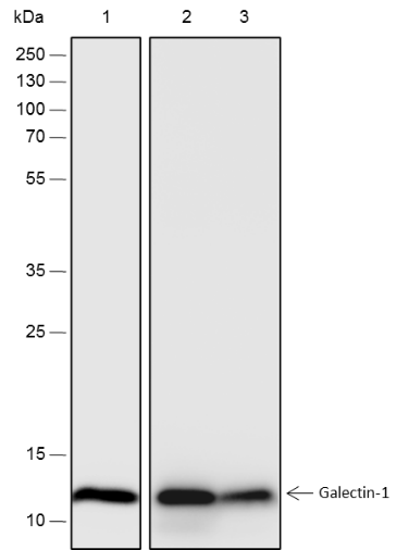 Anti-Galectin-1 Rabbit mAb