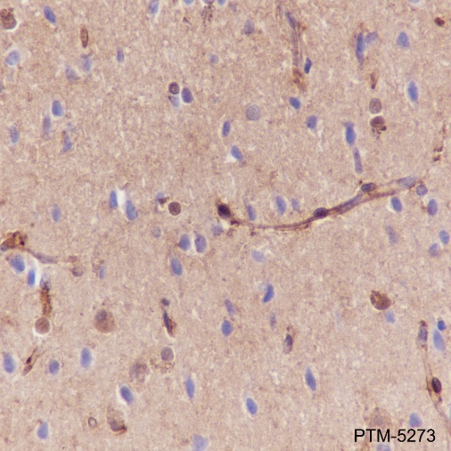 Anti-Galectin-1 Rabbit mAb